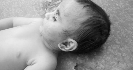 Bu gün ermeni katillerin öldürdüğü 2 yaşlı Zehra`nın ölüm yıl dönümü
