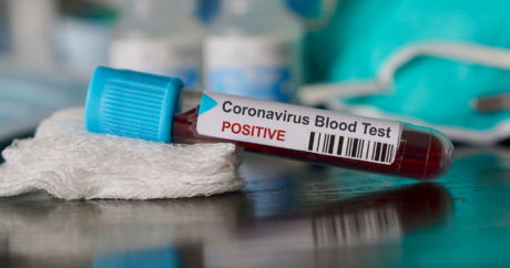 Koronavirüs Türkiye`de 37 can daha aldı