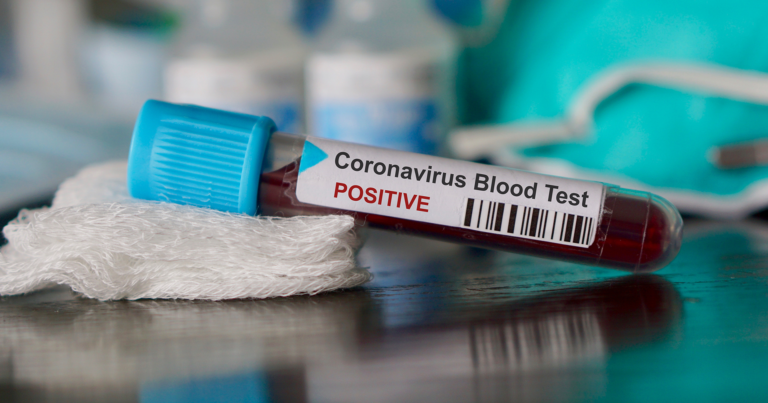 Azerbaycan’da koronavirüsten can kaybı 23 oldu