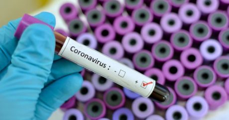 Özbekistan`da koronavirüs vaka sayısı 65`e yükseldi