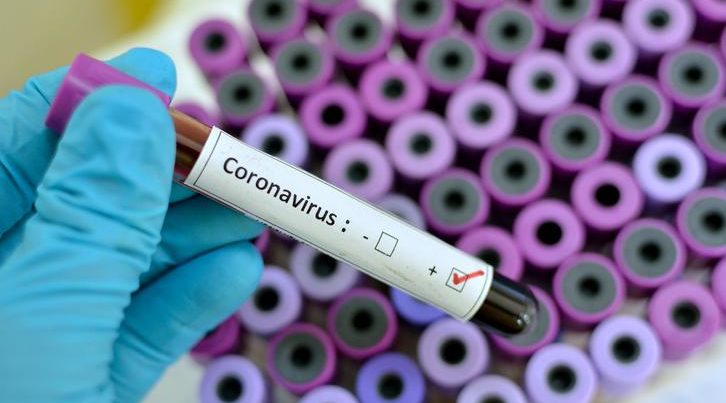 Özbekistan`da koronavirüs vaka sayısı 65`e yükseldi