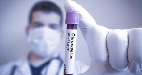 Azerbaycan’da koronavirüs vaka sayısı bin 373, can kaybı ise 18 oldu
