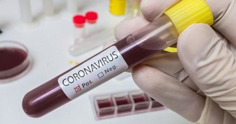 Kırgızistan`da 504 kişi koronavirüsü yendi