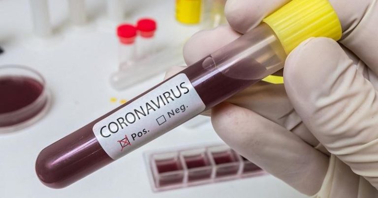 Kazakistan`da koronavirüs vaka sayısı 53