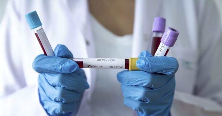 Türkiye’de virüsü yenen hasta sayısı 73 bini aştı