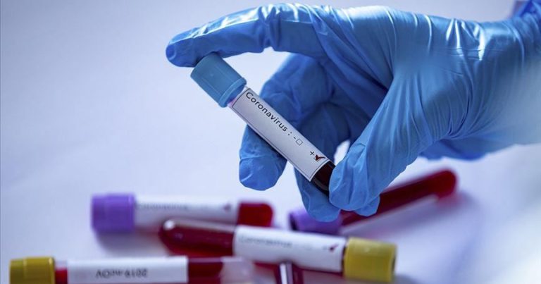 Özbekistan`da koronavirüs vaka sayısı 390`a ulaştı