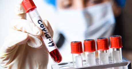 Kırgızistan`da 77 kişide daha koronavirüs tespit edildi